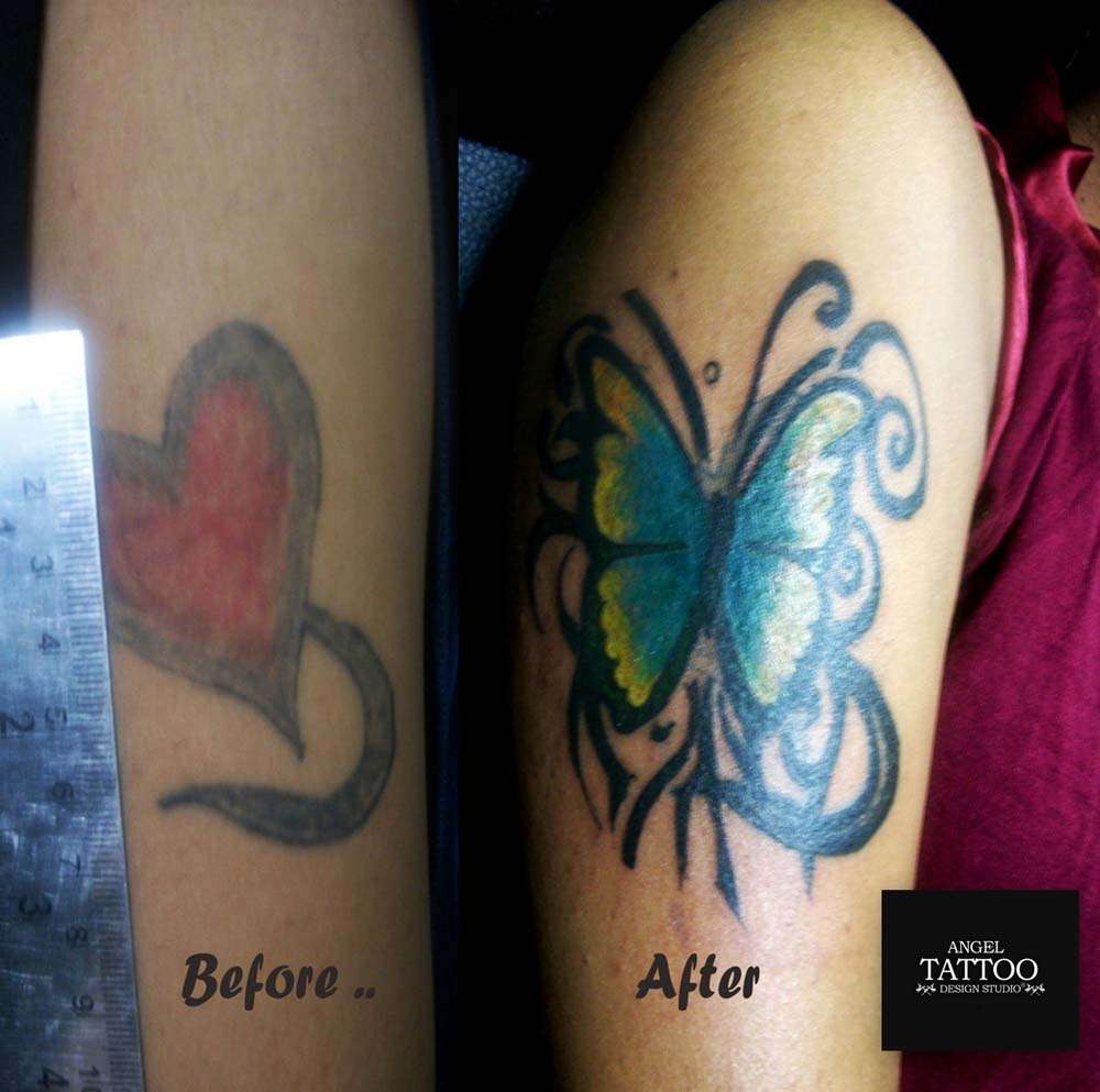 cover up tattoos in gurgaon